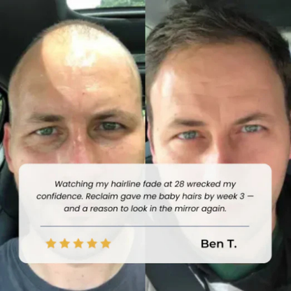 Bodywise™ - Advanced Hair Growth Roll-On Serum