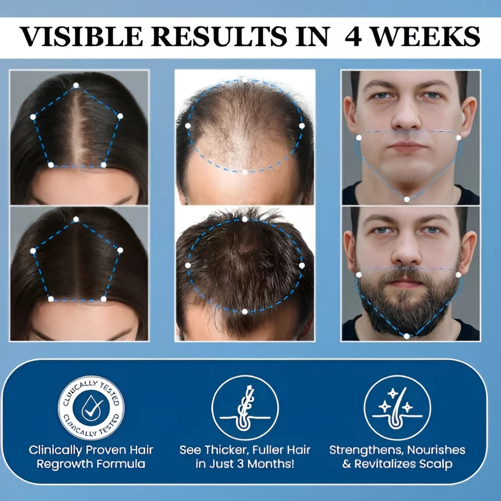 Bodywise™ - Advanced Hair Growth Roll-On Serum